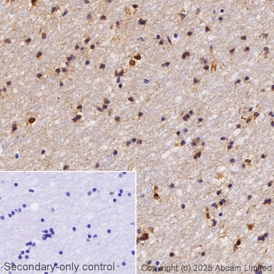 Immunohistochemistry (Formalin/PFA-fixed paraffin-embedded sections) - Anti-Apolipoprotein E antibody [EP1374Y] (AB52607)