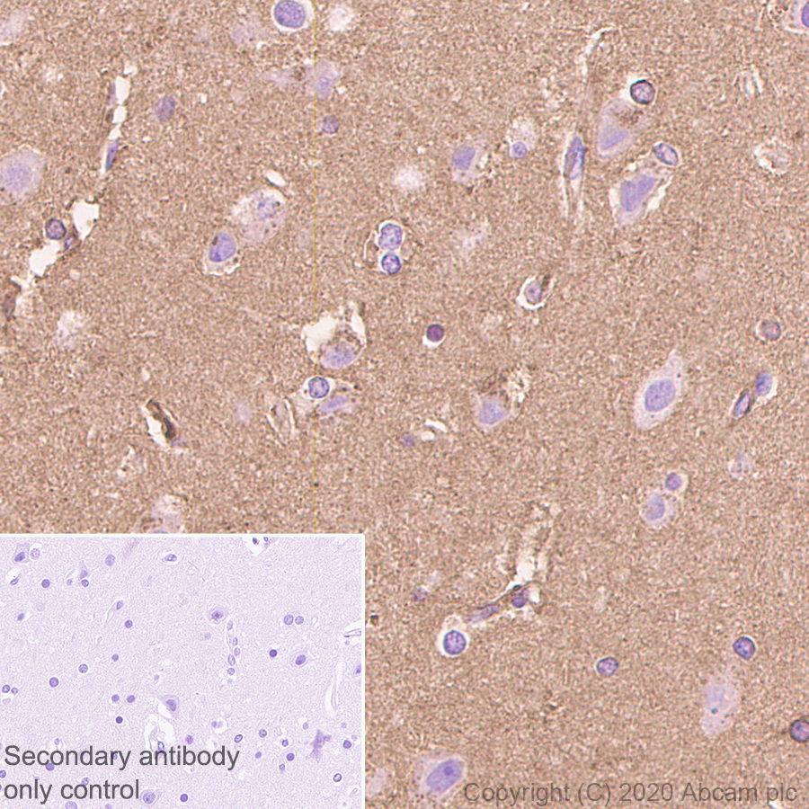 Immunohistochemistry (Formalin/PFA-fixed paraffin-embedded sections) - Anti-Apolipoprotein E antibody [EP1374Y] (AB52607), expandable thumbnail