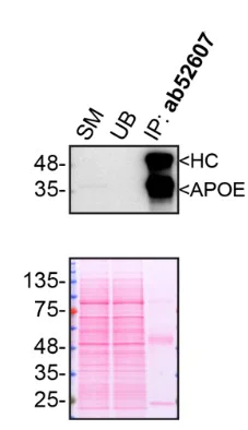 Immunoprecipitation - Anti-Apolipoprotein E antibody [EP1374Y] - BSA and Azide free (AB271843)
