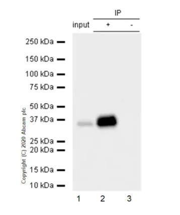 Immunoprecipitation - Anti-Apolipoprotein E antibody [EP1374Y] - BSA and Azide free (AB271843)