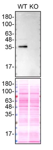 Western blot - Anti-Apolipoprotein E antibody [EP1374Y] - BSA and Azide free (AB271843)