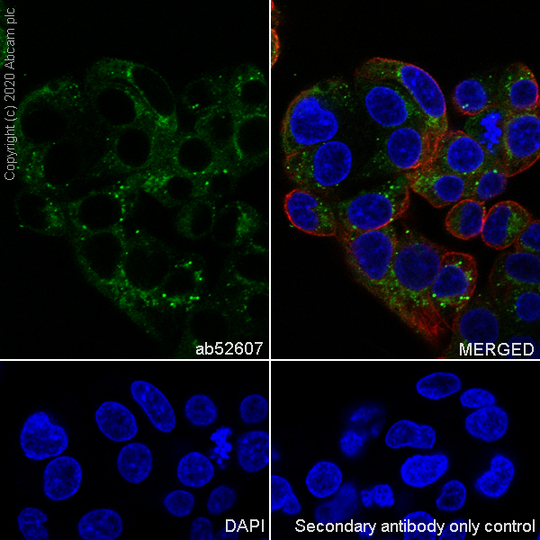 Immunocytochemistry/ Immunofluorescence - Anti-Apolipoprotein E antibody [EP1374Y] - Low endotoxin, Azide free (AB184845), expandable thumbnail