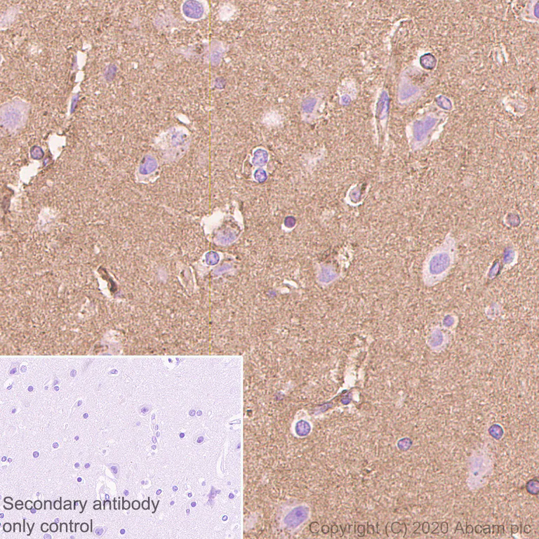 Immunohistochemistry (Formalin/PFA-fixed paraffin-embedded sections) - Anti-Apolipoprotein E antibody [EP1374Y] - Low endotoxin, Azide free (AB184845)