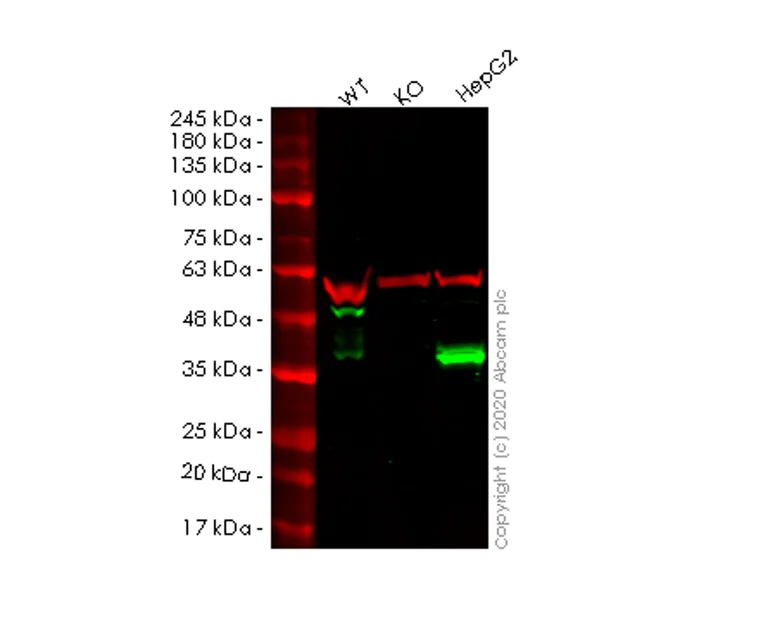 Western blot - Anti-Apolipoprotein E antibody [EP1374Y] - Low endotoxin, Azide free (AB184845)