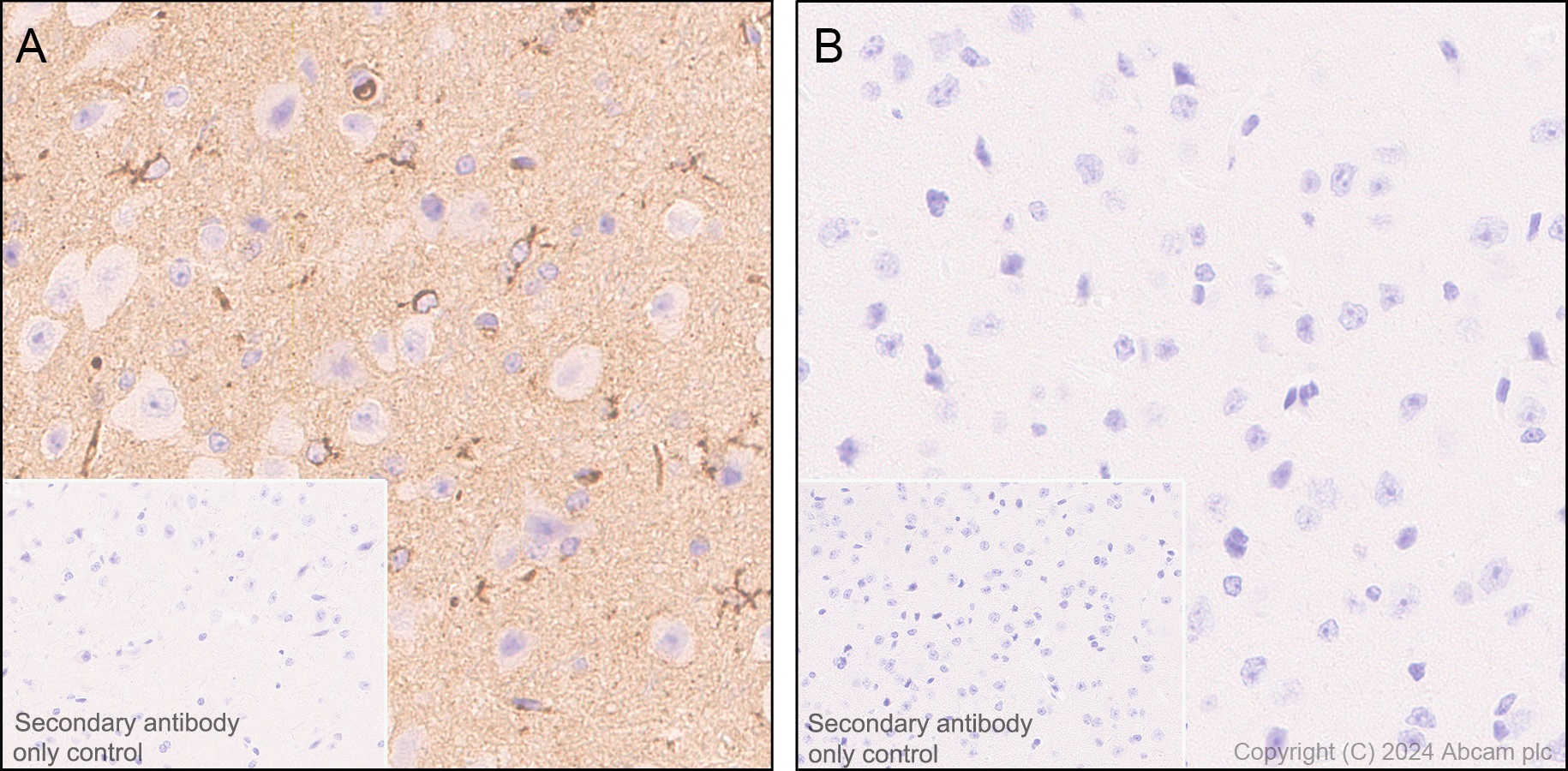 Immunohistochemistry (Formalin/PFA-fixed paraffin-embedded sections) - Anti-Apolipoprotein E antibody [EPR19378] (AB183596)