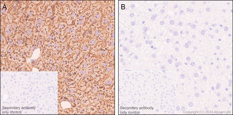 Immunohistochemistry (Formalin/PFA-fixed paraffin-embedded sections) - Anti-Apolipoprotein E antibody [EPR19378] (AB183596)