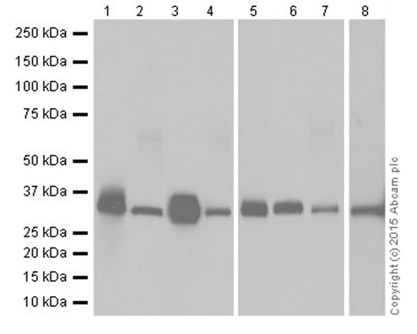 Western blot - Anti-Apolipoprotein E antibody [EPR19378] (AB183596)