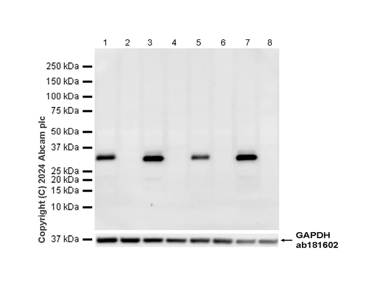 Western blot - Anti-Apolipoprotein E antibody [EPR19378] (AB183596)