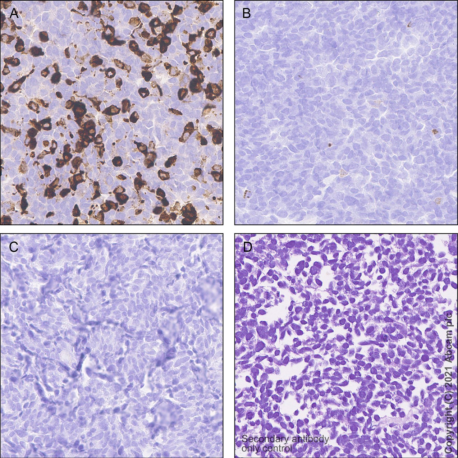 Immunohistochemistry (Formalin/PFA-fixed paraffin-embedded sections) - Anti-Apolipoprotein E4 antibody [EPR24181-64] - BSA and Azide free (ab279719), expandable thumbnail