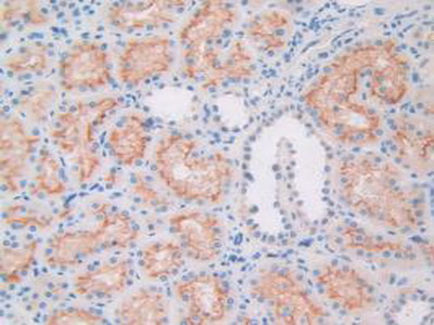 Immunohistochemistry (Formalin/PFA-fixed paraffin-embedded sections) - Anti-Apolipoprotein L1/APOL1 antibody (AB231523), expandable thumbnail