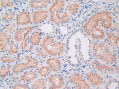 Immunohistochemistry (Formalin/PFA-fixed paraffin-embedded sections) - Anti-Apolipoprotein L1/APOL1 antibody (AB231523)