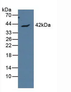 Western blot - Anti-Apolipoprotein L1/APOL1 antibody (AB231523)