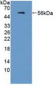 Western blot - Anti-Apolipoprotein L1/APOL1 antibody (AB231523)