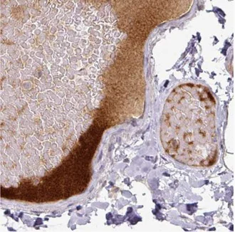 Immunohistochemistry (Formalin/PFA-fixed paraffin-embedded sections) - Anti-Apolipoprotein L1/APOL1 antibody [CL0171] (AB211462)