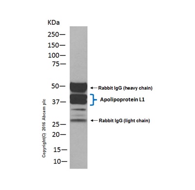 Immunoprecipitation - Anti-Apolipoprotein L1/APOL1 antibody [EPR2907(2)] (AB108315), expandable thumbnail
