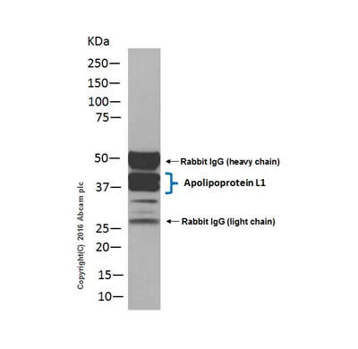 Immunoprecipitation - Anti-Apolipoprotein L1/APOL1 antibody [EPR2907(2)] (AB108315)