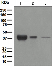 Western blot - Anti-Apolipoprotein L1/APOL1 antibody [EPR2907(2)] (AB108315), expandable thumbnail