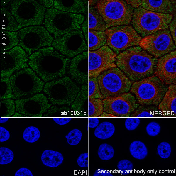 Immunocytochemistry/ Immunofluorescence - Anti-Apolipoprotein L1/APOL1 antibody [EPR2907(2)] - BSA and Azide free (AB169952)