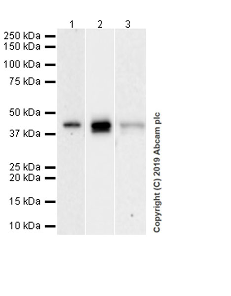 Western blot - Anti-Apolipoprotein L1/APOL1 antibody [EPRBOB-2-F1-1] (AB252217), expandable thumbnail