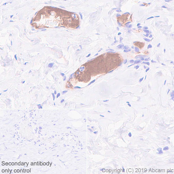 Immunohistochemistry (Formalin/PFA-fixed paraffin-embedded sections) - Anti-Apolipoprotein L1/APOL1 antibody [EPRBOB-2-F1-1] - BSA and Azide free (AB252391)