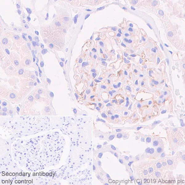 Immunohistochemistry (Formalin/PFA-fixed paraffin-embedded sections) - Anti-Apolipoprotein L1/APOL1 antibody [EPRBOB-2-F1-1] - BSA and Azide free (AB252391)