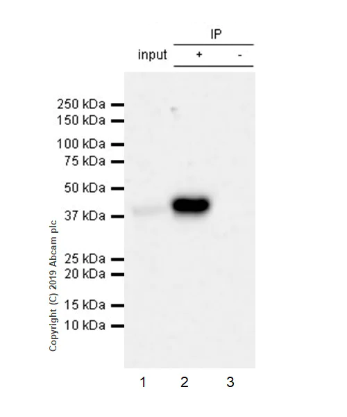 Immunoprecipitation - Anti-Apolipoprotein L1/APOL1 antibody [EPRBOB-2-F1-1] - BSA and Azide free (AB252391)
