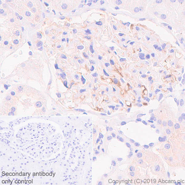 Immunohistochemistry (Formalin/PFA-fixed paraffin-embedded sections) - Anti-Apolipoprotein L1/APOL1 antibody [EPRBOB-2-F1-17] (AB252218)