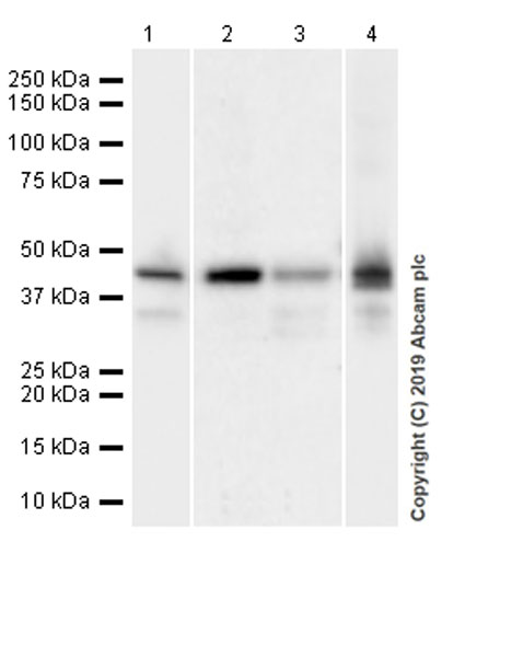 Western blot - Anti-Apolipoprotein L1/APOL1 antibody [EPRBOB-2-F1-17] (AB252218), expandable thumbnail
