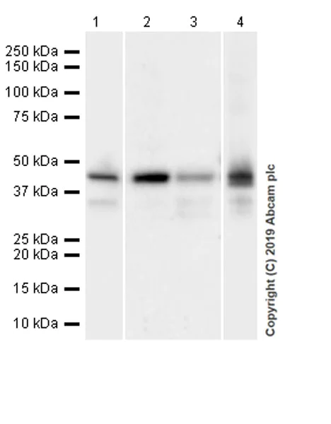Western blot - Anti-Apolipoprotein L1/APOL1 antibody [EPRBOB-2-F1-17] (AB252218)