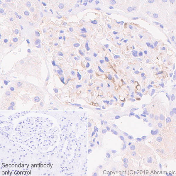 Immunohistochemistry (Formalin/PFA-fixed paraffin-embedded sections) - Anti-Apolipoprotein L1/APOL1 antibody [EPRBOB-2-F1-17] - BSA and Azide free (AB252392), expandable thumbnail