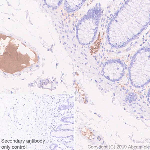 Immunohistochemistry (Formalin/PFA-fixed paraffin-embedded sections) - Anti-Apolipoprotein L1/APOL1 antibody [EPRBOB-2-F1-17] - BSA and Azide free (AB252392)