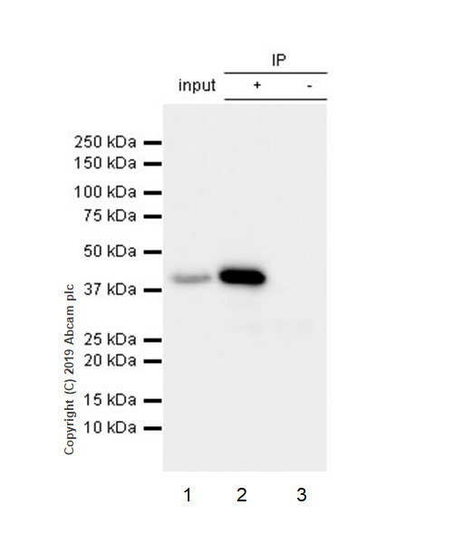 Immunoprecipitation - Anti-Apolipoprotein L1/APOL1 antibody [EPRBOB-2-F1-17] - BSA and Azide free (AB252392), expandable thumbnail