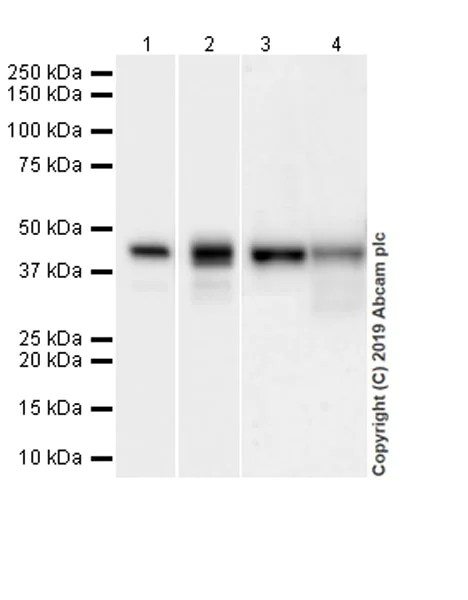 Western blot - Anti-Apolipoprotein L1/APOL1 antibody [EPRBOB-2-F1-53] (AB252219)