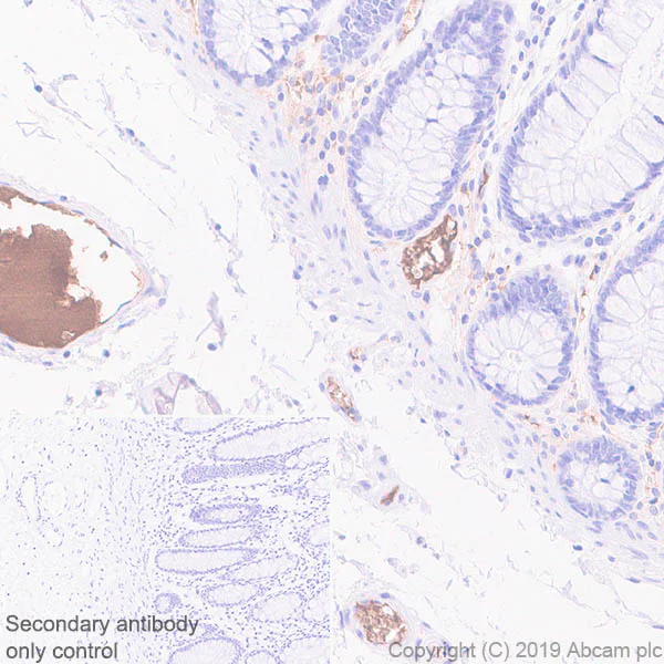 Immunohistochemistry (Formalin/PFA-fixed paraffin-embedded sections) - Anti-Apolipoprotein L1/APOL1 antibody [EPRBOB-2-F1-53] - BSA and Azide free (AB252393)