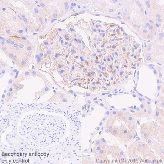 Immunohistochemistry (Formalin/PFA-fixed paraffin-embedded sections) - Anti-Apolipoprotein L1/APOL1 antibody [EPRBOB-2-F1-53] - BSA and Azide free (AB252393), expandable thumbnail