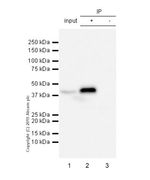 Immunoprecipitation - Anti-Apolipoprotein L1/APOL1 antibody [EPRBOB-2-F1-53] - BSA and Azide free (AB252393), expandable thumbnail