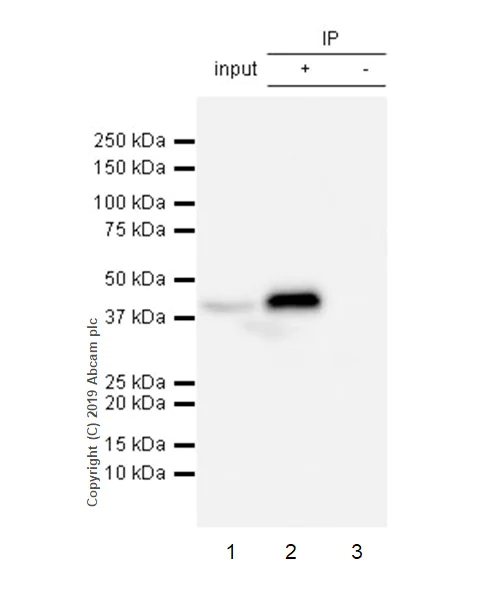 Immunoprecipitation - Anti-Apolipoprotein L1/APOL1 antibody [EPRBOB-2-F1-53] - BSA and Azide free (AB252393)