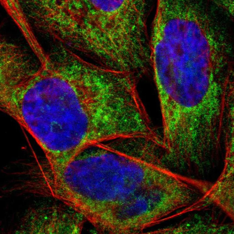 Immunocytochemistry/ Immunofluorescence - Anti-Apolipoprotein O antibody (AB246865)