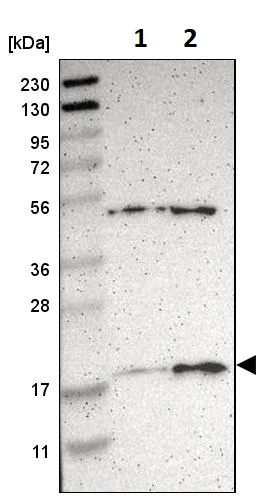Western blot - Anti-Apolipoprotein O antibody (AB246865)