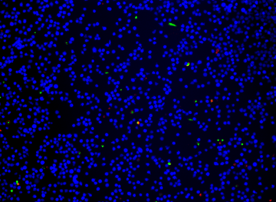 Fluorescence Microscopy - Apoptosis/ Necrosis Assay Kit (blue, green, red) (AB176749), expandable thumbnail