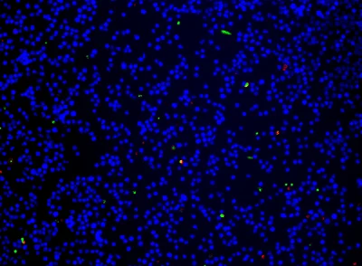 Fluorescence Microscopy - Apoptosis/ Necrosis Assay Kit (blue, green, red) (AB176749)