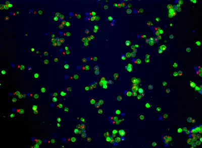 Fluorescence Microscopy - Apoptosis/ Necrosis Assay Kit (blue, green, red) (AB176749)