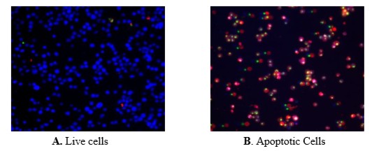 Fluorescence Microscopy - Apoptosis/ Necrosis Assay Kit (blue, red, green) (AB176750)