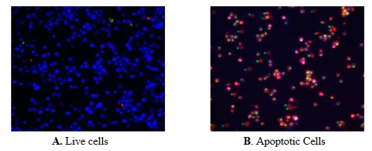 Fluorescence Microscopy - Apoptosis/ Necrosis Assay Kit (blue, red, green) (AB176750)