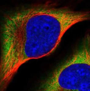 Immunocytochemistry/ Immunofluorescence - Anti-APP-1 antibody (AB220832)
