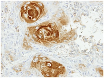 Immunohistochemistry (Formalin/PFA-fixed paraffin-embedded sections) - Anti-APPBP2 antibody (AB151305), expandable thumbnail