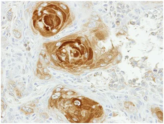 Immunohistochemistry (Formalin/PFA-fixed paraffin-embedded sections) - Anti-APPBP2 antibody (AB151305)