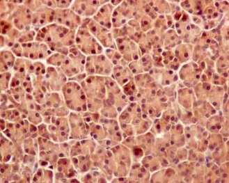 Immunohistochemistry (Formalin/PFA-fixed paraffin-embedded sections) - Anti-APPL antibody [EPR13569] (AB180140)