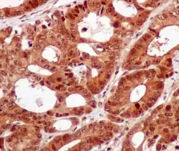 Immunohistochemistry (Formalin/PFA-fixed paraffin-embedded sections) - Anti-APPL antibody [EPR13569] - BSA and Azide free (AB250150)
