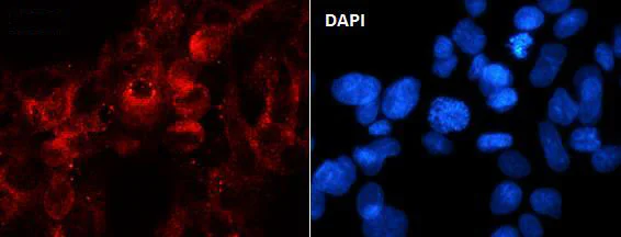 Immunocytochemistry/ Immunofluorescence - Anti-APPL antibody [SR3775] (AB326696)
